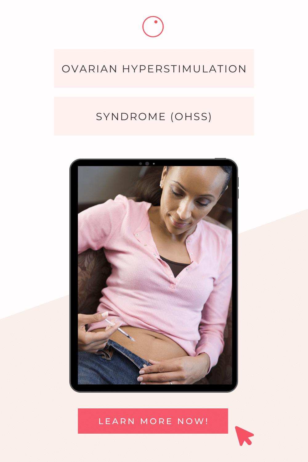 Ovarian Hyperstimulation Syndrome (OHSS)
