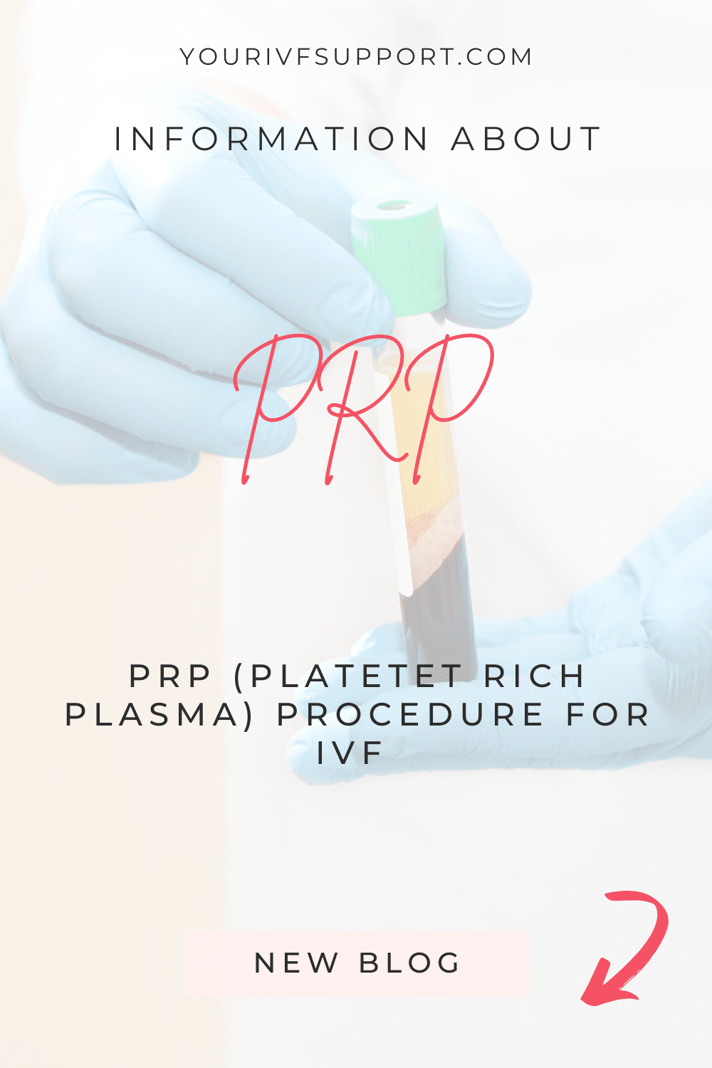 PRP Procedure for IVF Failures