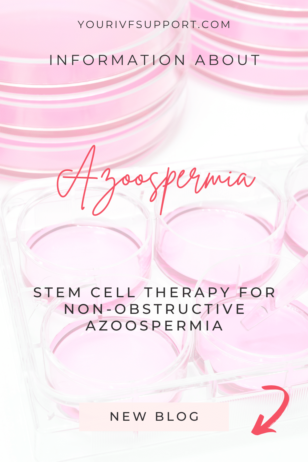 StemCell Therapy for non-obstructive Azoospermie