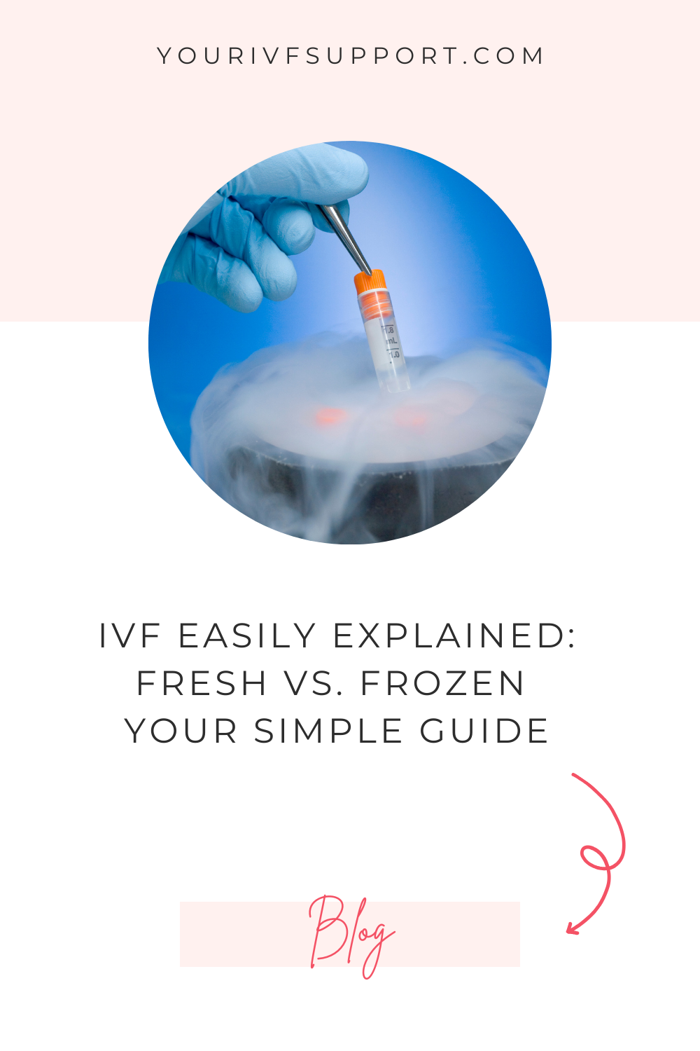IVF leicht erklärt: Frisch oder eingefroren - dein einfacher Leitfaden