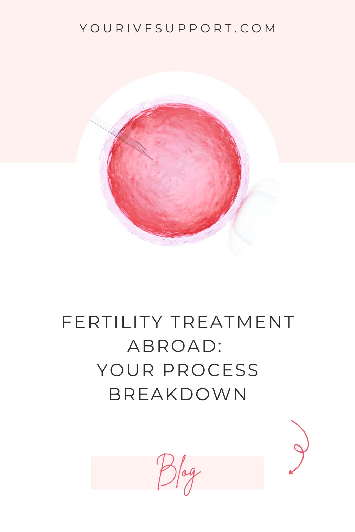 IVF Process abroad